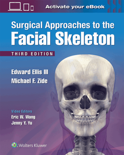 Surgical Approaches to the Facial Skeleton (3rd Edition)