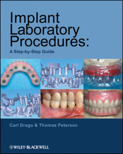 Implant Laboratory Procedures: A Step-by-Step Guide