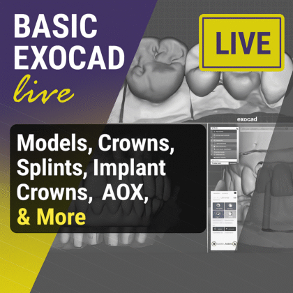 BASIC EXOCAD: Models, Crowns, Splints, Implant Crowns, AOX, & More
