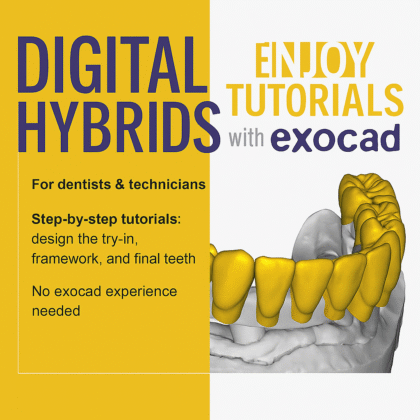 Digital Hybrids for Dentists & Technicians
